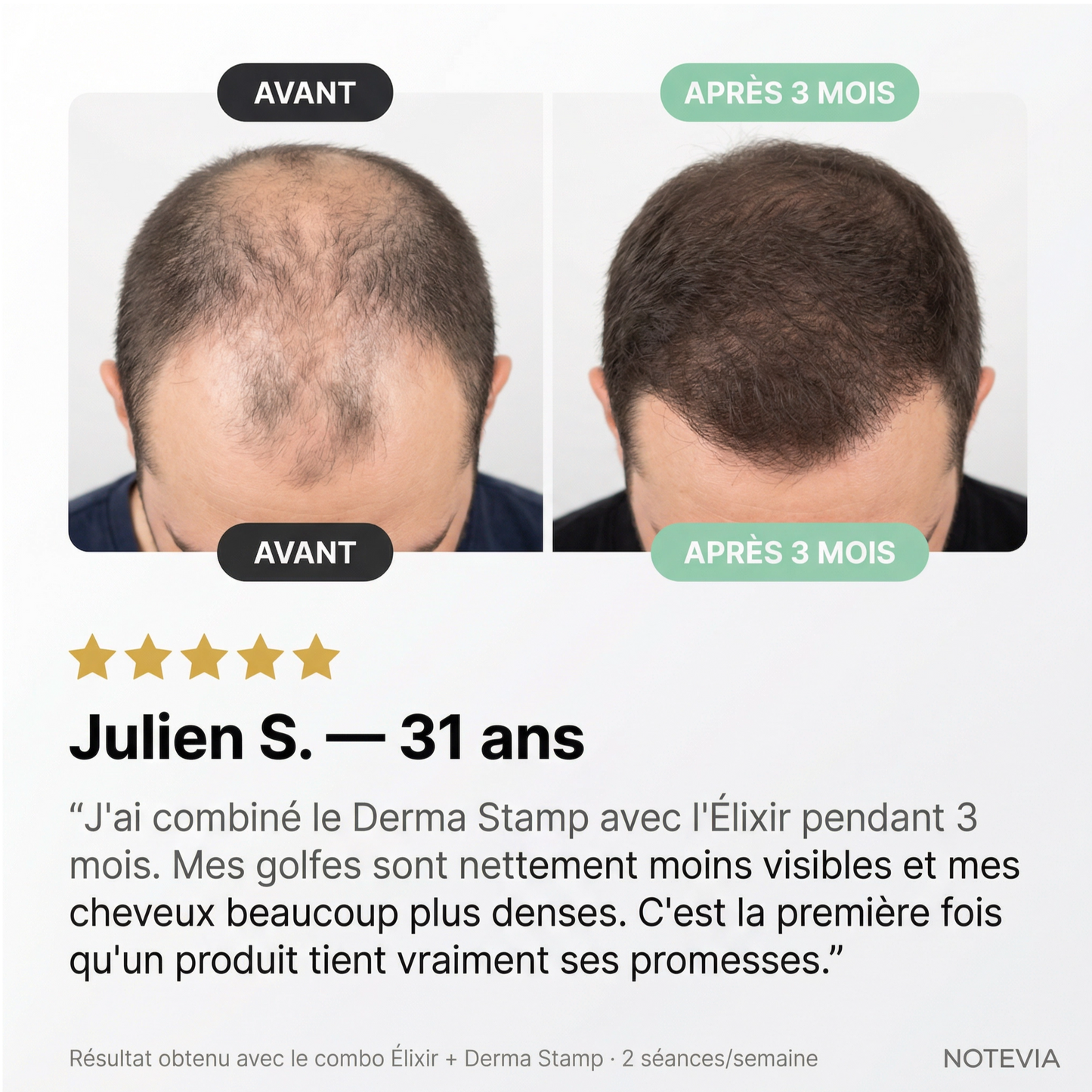 Derma Stamp
