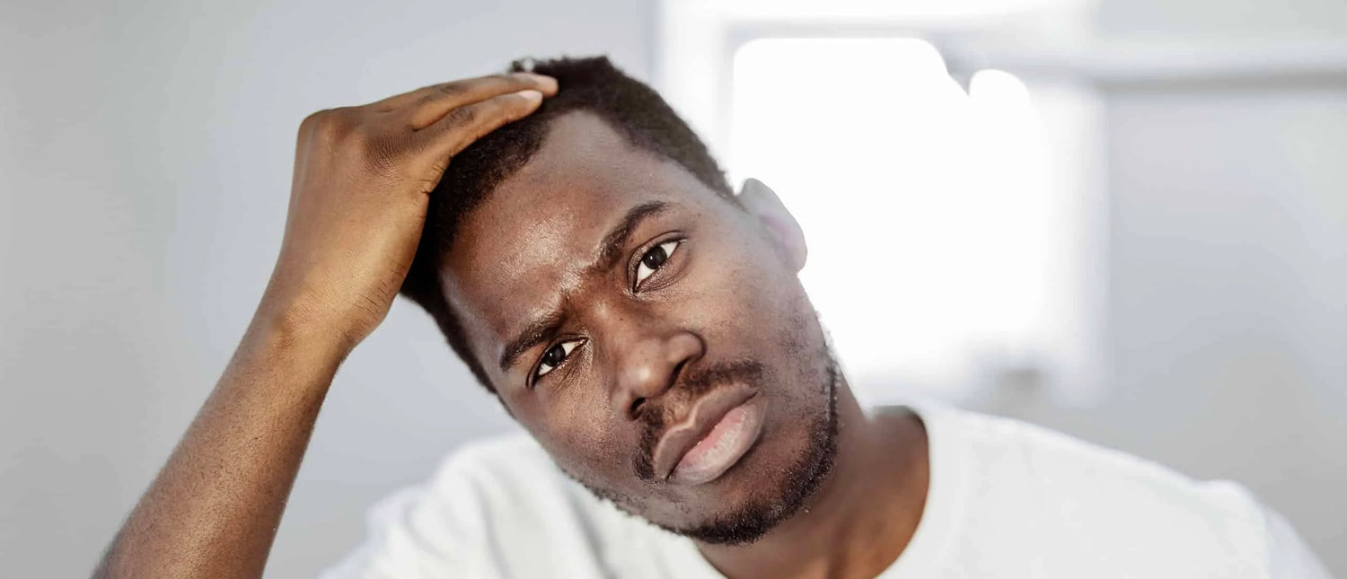 Qu'est-ce que l'alopécie ?