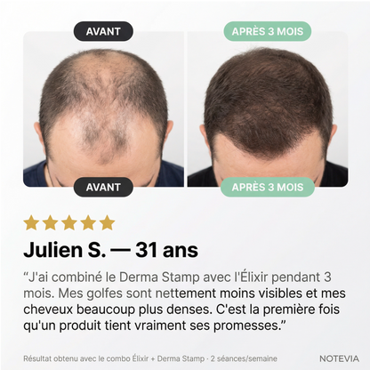 Derma Stamp